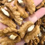 Noticing a Lump on Your Hand? Here’s What You Need to Know — When to Worry (and When Not To)