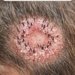 What the Veins on Your Hands Might Reveal About Your Kidney Health