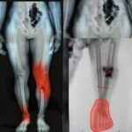 Why Do Skin Bumps Appear on the Neck? Causes, Prevention, and Treatment