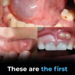 Slow Cooker Peach Dump Cake: The 4-Ingredient Dessert Everyone Will Beg For