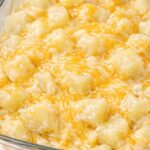 Here’s what you need to know about tonsil stones – the weird pimple-like growths in your throat