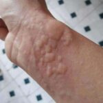 Mountain Dew Apple Dumplings!!!