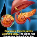 My neighbor brought this to a potluck once and everyone asked for the recipe. I still can’t believe it only takes 4 ingredients!