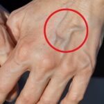 If You Have These Lines on Your Nails After 40, Your Body May Be Trying to Tell You Something