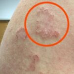 I Woke Up in the Middle of the Night Convinced Something Was Biting My Skin
