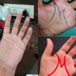 When to Worry About Veins That Appear Out of Nowhere: A Compassionate Guide to Vascular Health